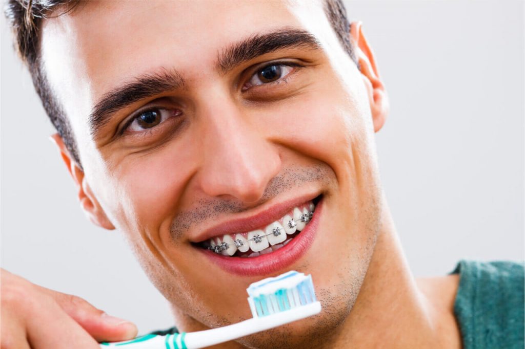 5 Improvements Of Your Teeth After Braces