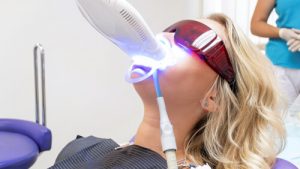 Laser Surgery Teeth Whitening